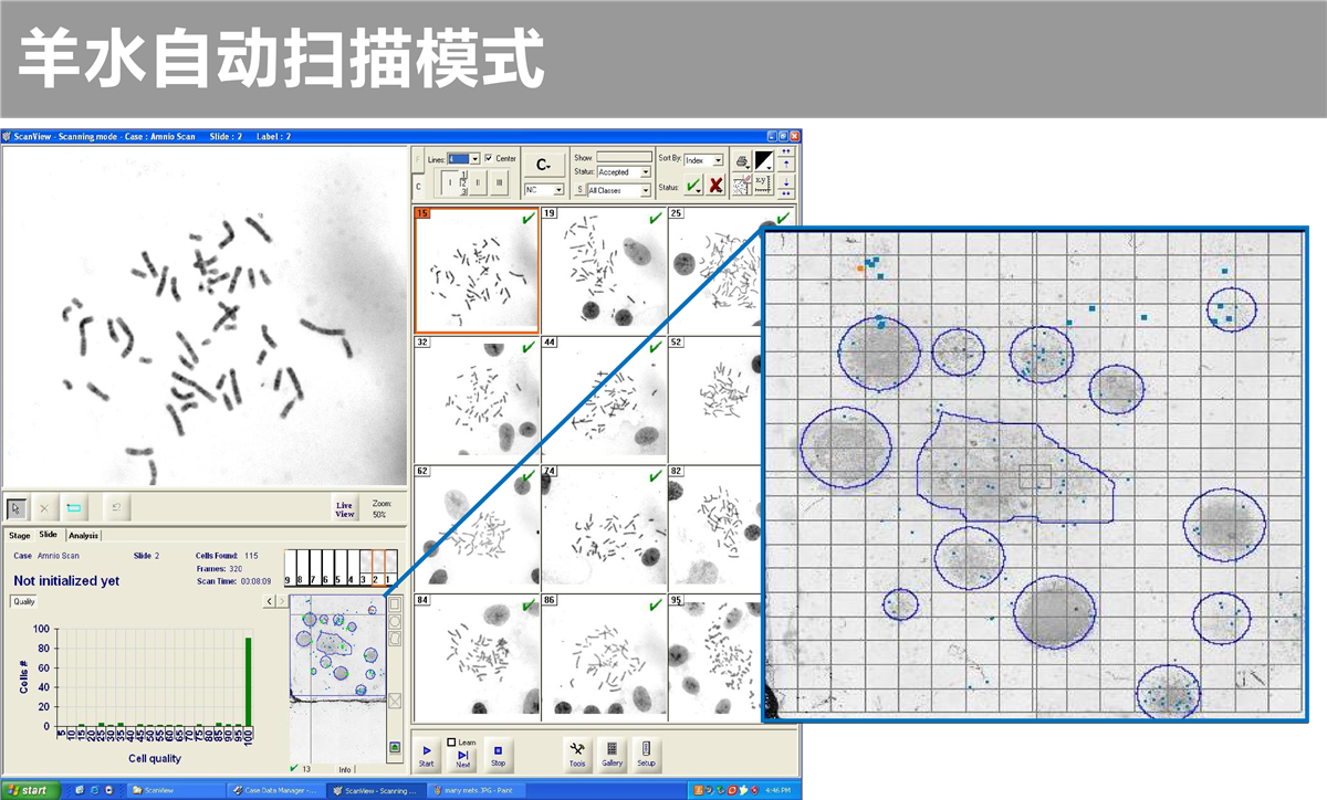 自动染色体扫描系统