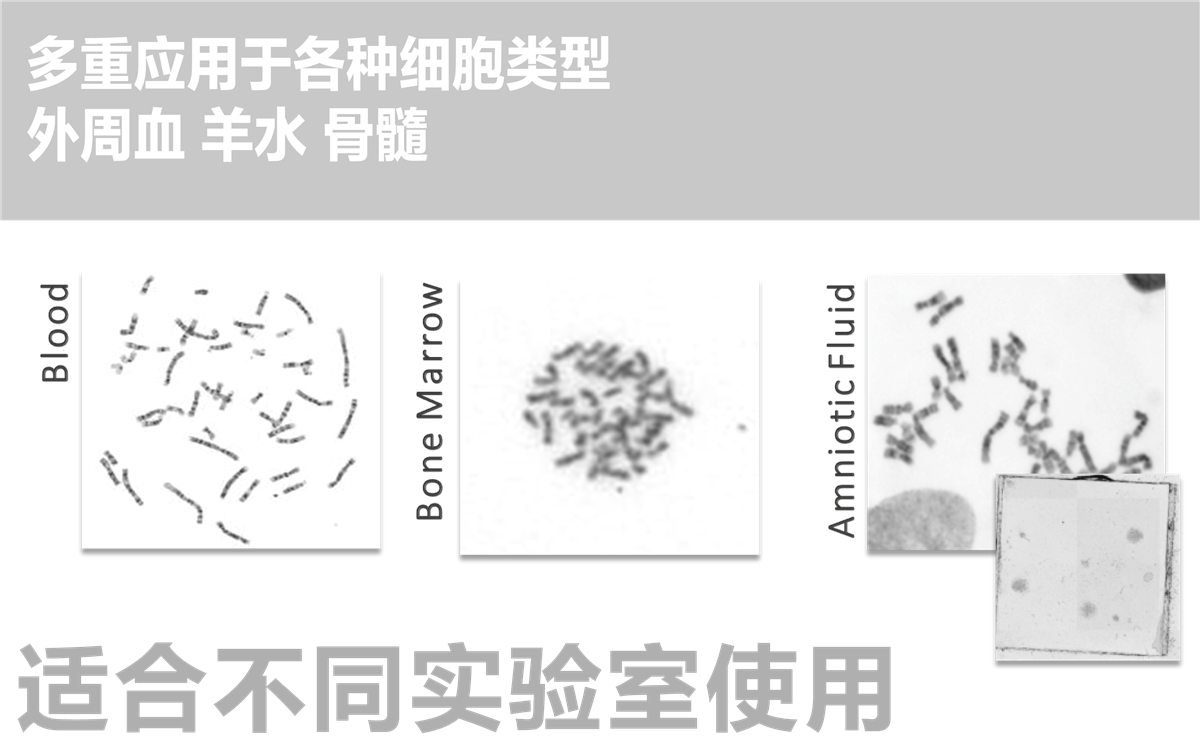 自动染色体扫描系统