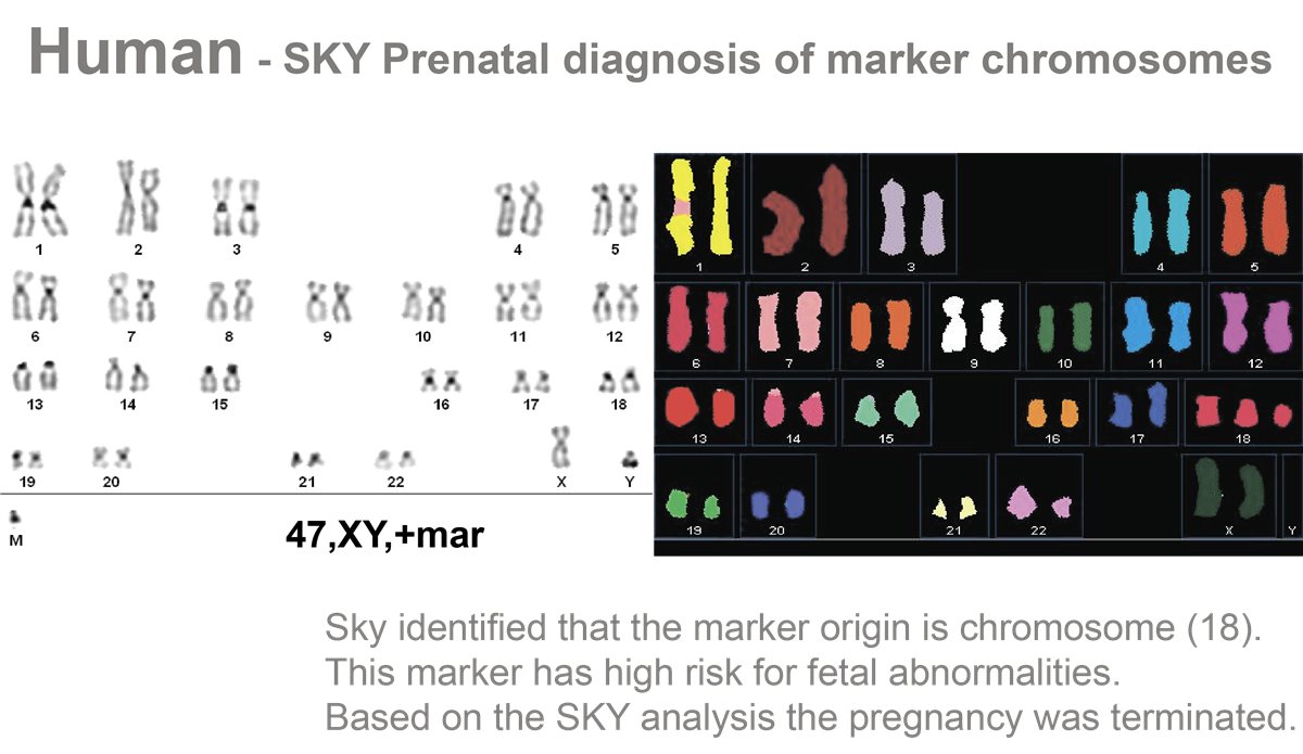 HiSKY光谱核型比对分析系统