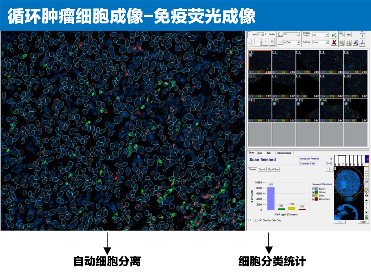 CTC扫描成像检测