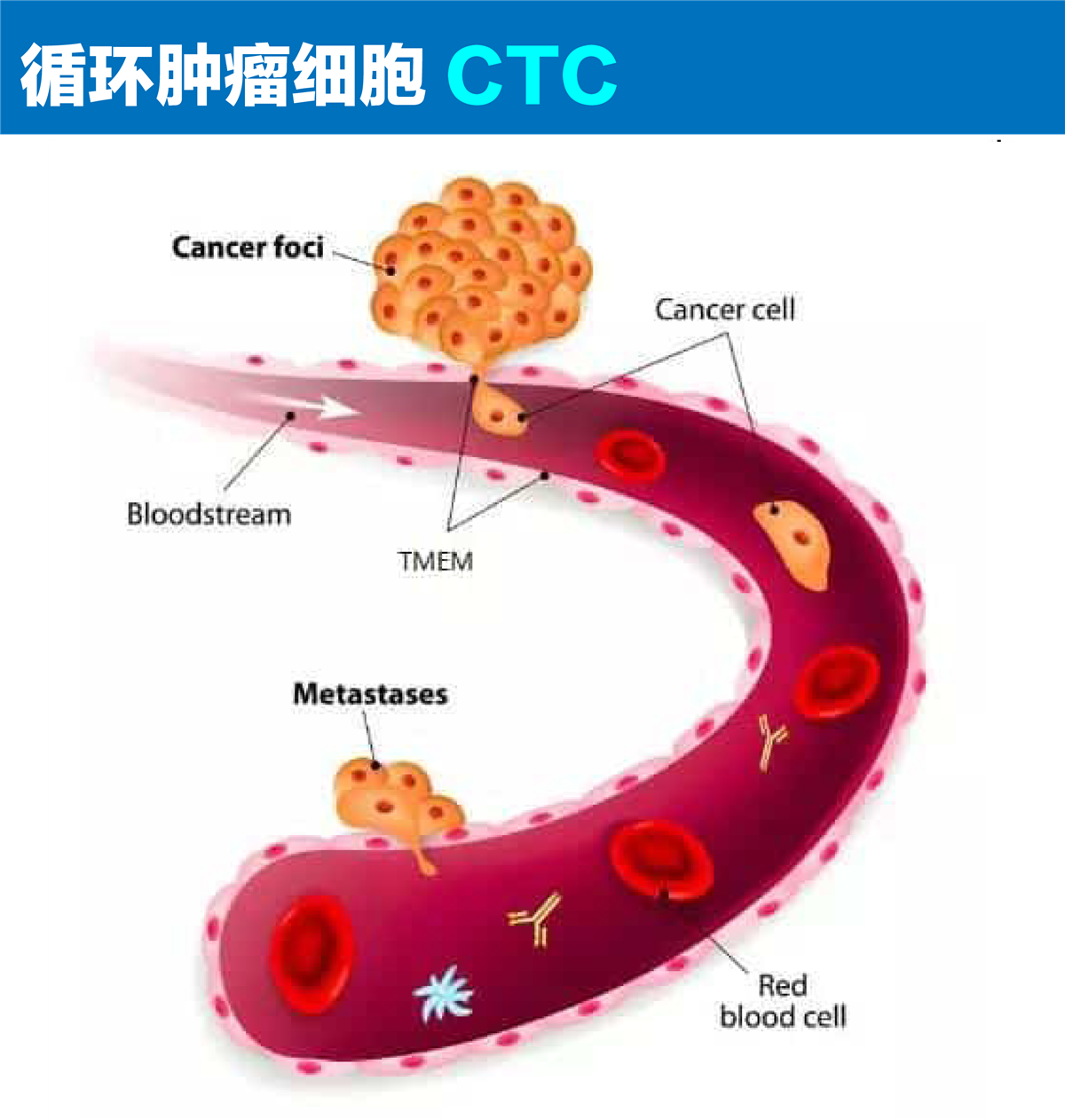 CTC扫描成像检测
